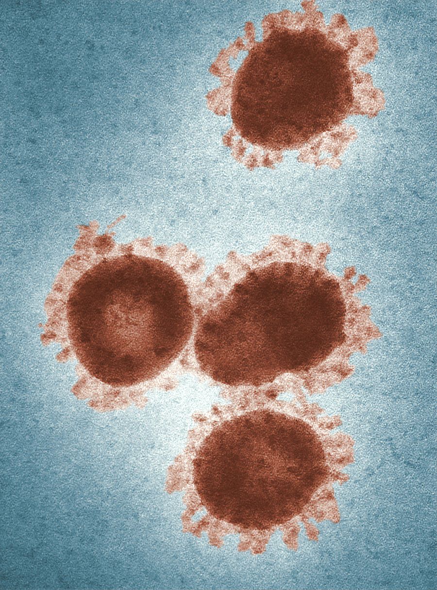 virus web